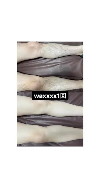 Epina 千葉店 【エピナ】のエステ・リラクイメージ