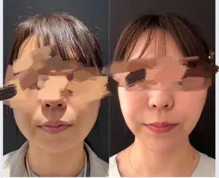 sanuki yuiのその他イメージ