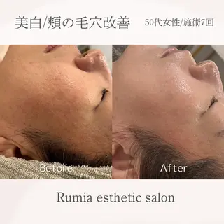 Rumia esthetic salon所属・Rumia emi🧸のエステ・リラクイメージ