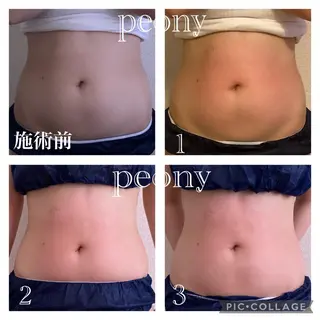 デトックス美容専門サロンpeony所属・デトックス美容専門 サロンpeonyのエステ・リラクイメージ