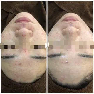 ロング カラー パーマ ヘアアレンジ メンズ キッズ ネイル マツエク・マツパ Amaryllis 🌹のエステ・リラクイメージ