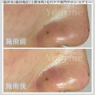 毛穴ケア専門サロン Yourmeユアミーのエステ・リラクイメージ