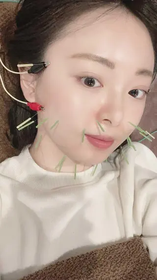 メンズ 美容鍼灸サロン LOMIHARIのエステ・リラクイメージ