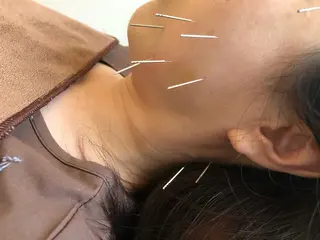 水島 秀輝（美容鍼灸師）のその他イメージ