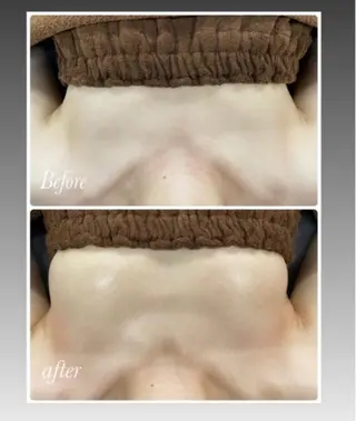 FLEUR大阪・整体 ・ハイフ・痩身・小顔のエステ・リラクイメージ