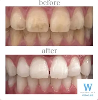 ホワイトニング ショップ本八幡店のエステ・リラクイメージ