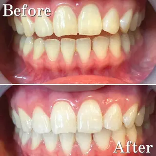 ロング ヘアアレンジ メンズ カラー パーマ ネイル アイブロウ マツエク・マツパ LBSホワイトニング 銀座店💎店長浦和のその他イメージ