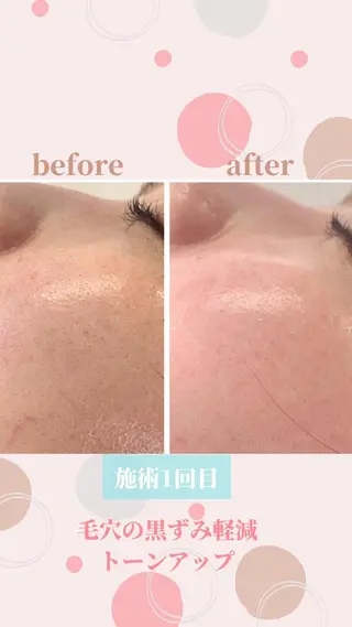 小顔&デコルテ Spa “koti”のエステ・リラクイメージ