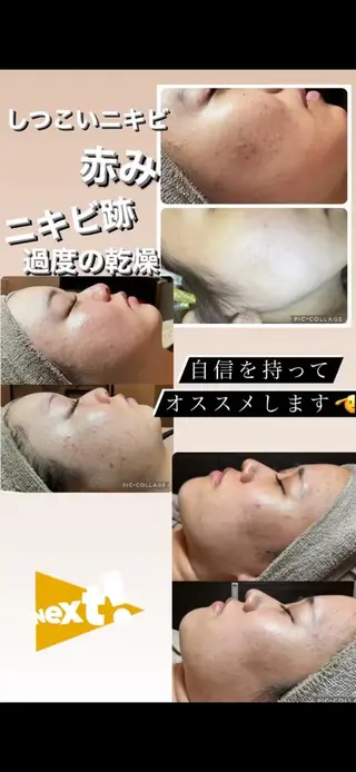 エステ✖️ネイル Feelのネイルデザイン