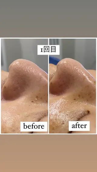 アルカンジュ~archange~所属・痩身/毛穴洗浄/脱毛 アルカンジュのエステ・リラクイメージ