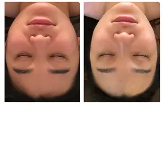 FLEUR大阪・美容 整体・痩身・小顔のエステ・リラクイメージ