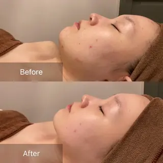 BEIGE 金山 🌹RUKAのマツエク・マツパデザイン