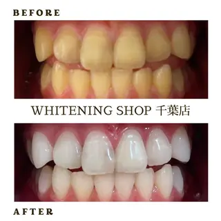 メンズ ホワイトニング ショップ千葉店のその他イメージ