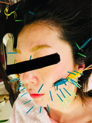 アロマ･美容鍼･カッ ピング「麗」鍼灸院のエステ・リラクイメージ