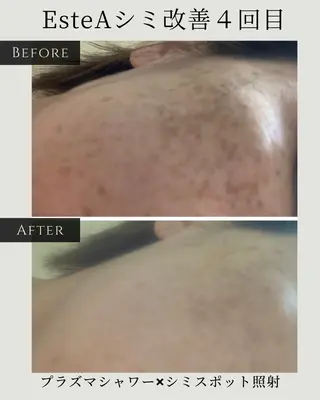 シミ毛穴ケア EsteAのエステ・リラクイメージ