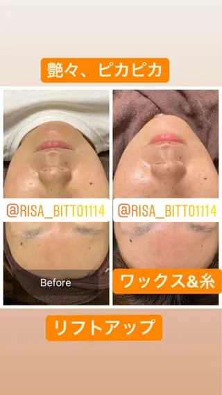 産毛専門店 Bittoのエステ・リラクイメージ