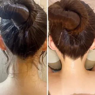 うなじ脱毛/美肌脱毛 LABELのエステ・リラクイメージ