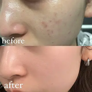 🦋肌質改善サロン. maho🦋のエステ・リラクイメージ