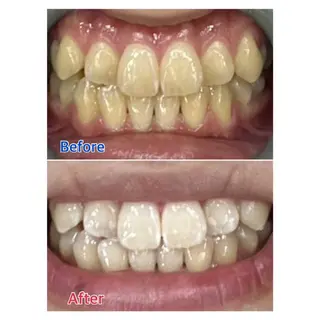 MBEAUTYSALON 千葉店・京成大久保所属・Melty 輝のその他イメージ