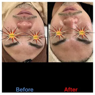 メンズ 韓国美肌・小顔 骨格エステNoahのエステ・リラクイメージ