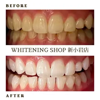 メンズ ホワイトニング ショップ新小岩店のその他イメージ