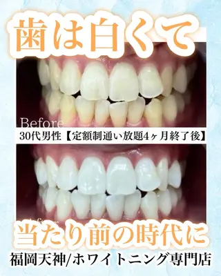 メンズ キッズ ホワイトニング専門店 WHITE天神店のエステ・リラクイメージ