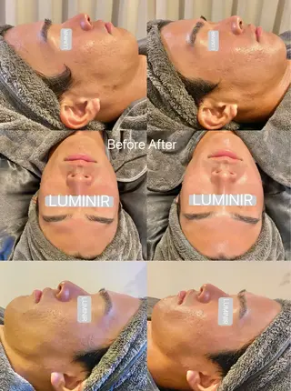 LUMINIR-ルミニール-所属・ハーブピーリング/ 肌質改善ルミニールのエステ・リラクイメージ