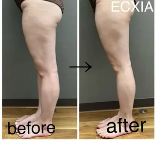 ECXIA 【エクシア】のエステ・リラクイメージ