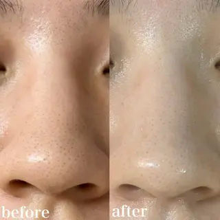 WHITE AQUA 北千住店のエステ・リラクイメージ