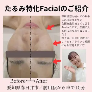 PRETTIEST SHINE所属・山田 浩子のエステ・リラクイメージ