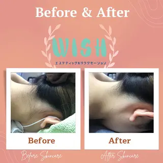 WISH 美肌脱毛のプロ！須藤のエステ・リラクイメージ