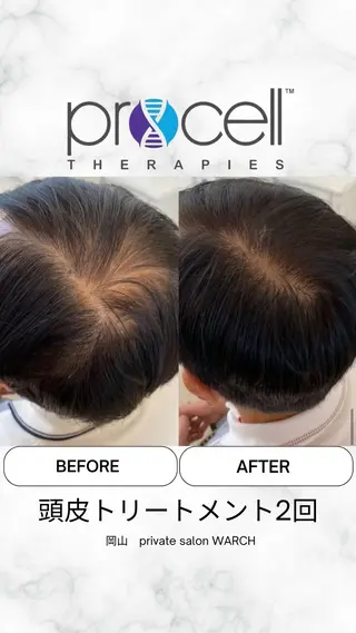 WARCH Marieのその他イメージ