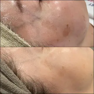 LiZA エステティックサロンのエステ・リラクイメージ