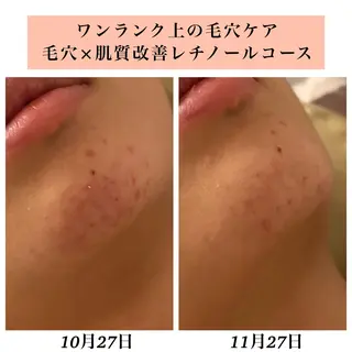 Bellesthe (ベルエステ)のエステ・リラクイメージ