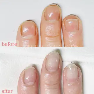 ネイル 深爪・巻き爪 専門サンセリテのネイルデザイン