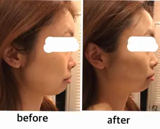 アクシア ビューティー サロン所属・究極のアンチエイ ジングサロンのエステ・リラクイメージ