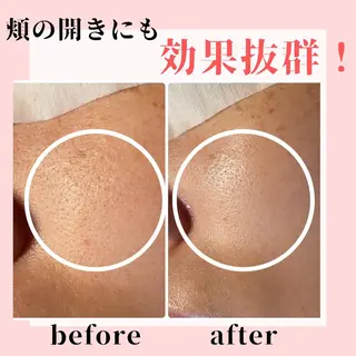 ピーリング専門店 Belluteのエステ・リラクイメージ