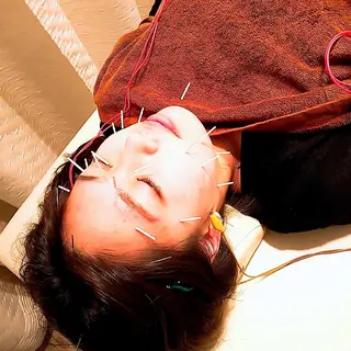 むくみたるみ専門☆ 美容鍼・小顔矯正のエステ・リラクイメージ