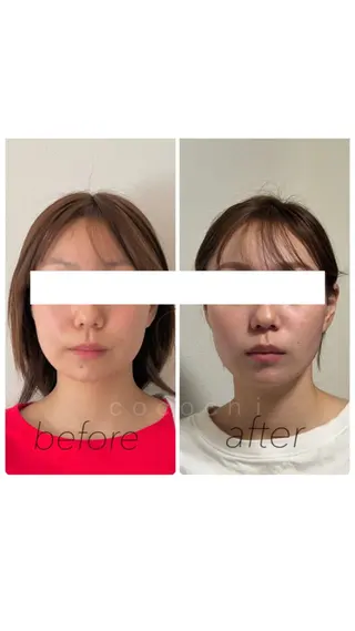 小顔と ヘッドスパのお店のエステ・リラクイメージ