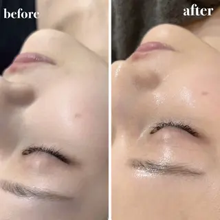 NAZ  (ナーズ)のエステ・リラクイメージ