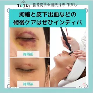 小顔痩身インディバ Nana表参道のエステ・リラクイメージ