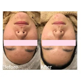 BestBelleꕤ 大阪福島/肌質改善のエステ・リラクイメージ