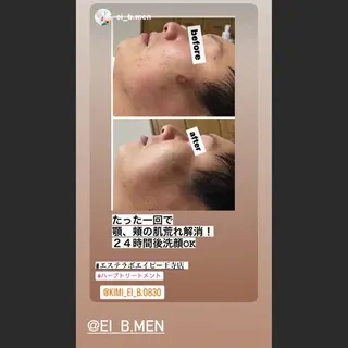 ダイエット／脱毛 美顔／フォト／ハーブのその他イメージ