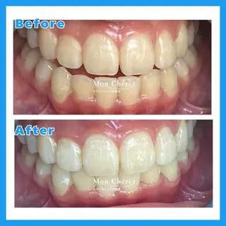 Mon Cheri 広島店のエステ・リラクイメージ