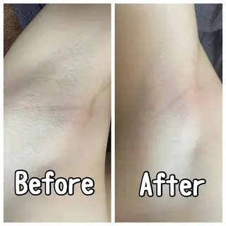 都度払い制脱毛サロンBe Charm所属・Be Charm 山﨑のエステ・リラクイメージ