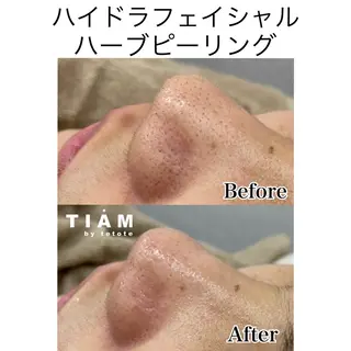 美肌サロンTIAM by tetoteのエステ・リラクイメージ