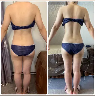 FLEUR大阪・整体 ・ハイフ・痩身・小顔のエステ・リラクイメージ