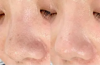 メンズ salonLADYSTYLE所属・稲嶺 美華のエステ・リラクイメージ