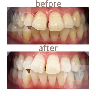 ホワイトニング ショップ船橋店のエステ・リラクイメージ