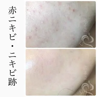 ハーブピーリング専門 BIOEL横浜のエステ・リラクイメージ